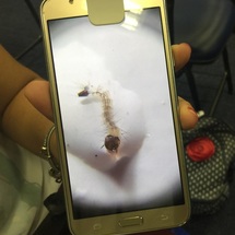 A phone screen showing a mosquito larvae.