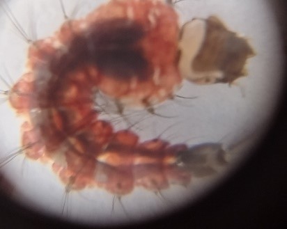 A photo of a mosquito larvae