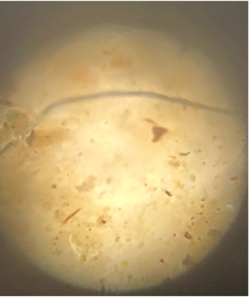 A microscope view showing a microplastic fiber
